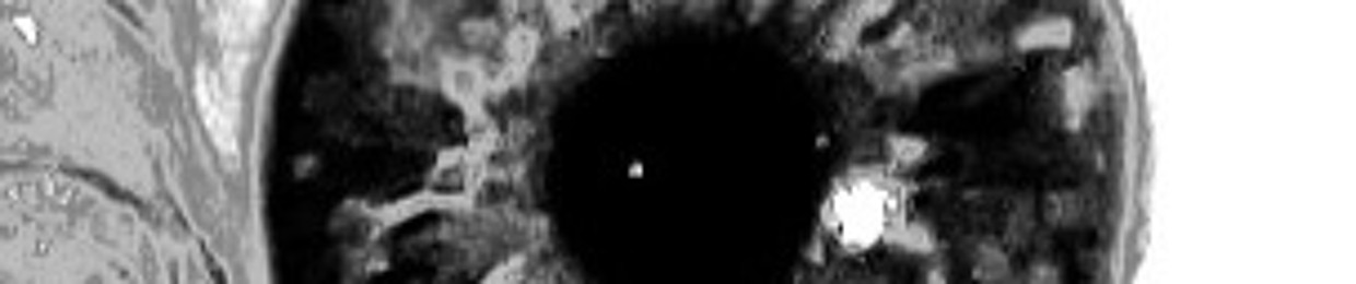 Lucid Corpse