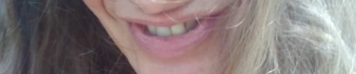 TeslaUniversalActivateD