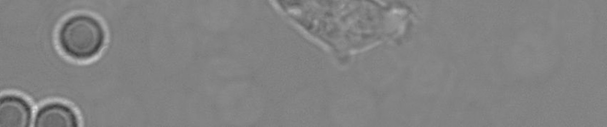 Amoeba From Andromeda