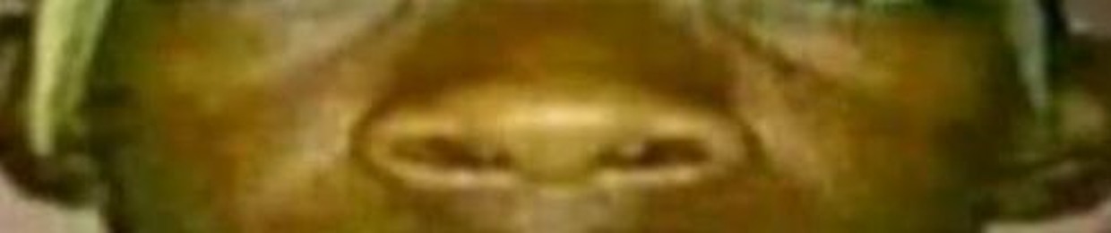 DnM