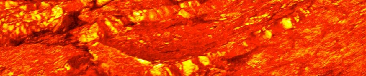 MAGMA