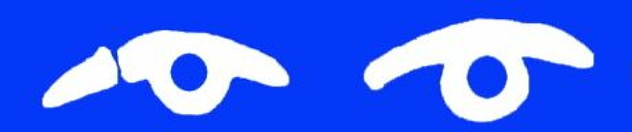 MIKEY BANNER
