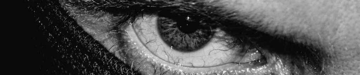 Cataract