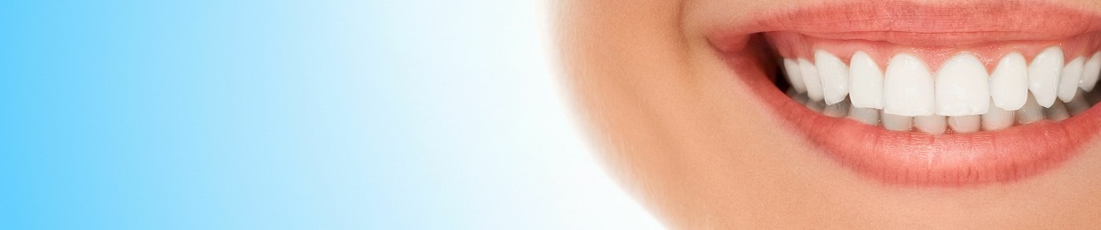 My Dental Implants