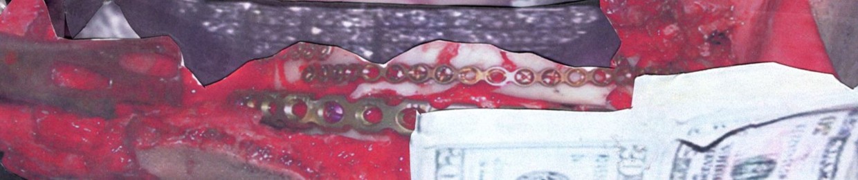 SPINAL TECHNICIAN / DOWN CLUB