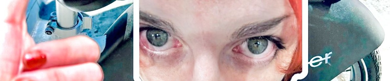 Anne Has No Pulse