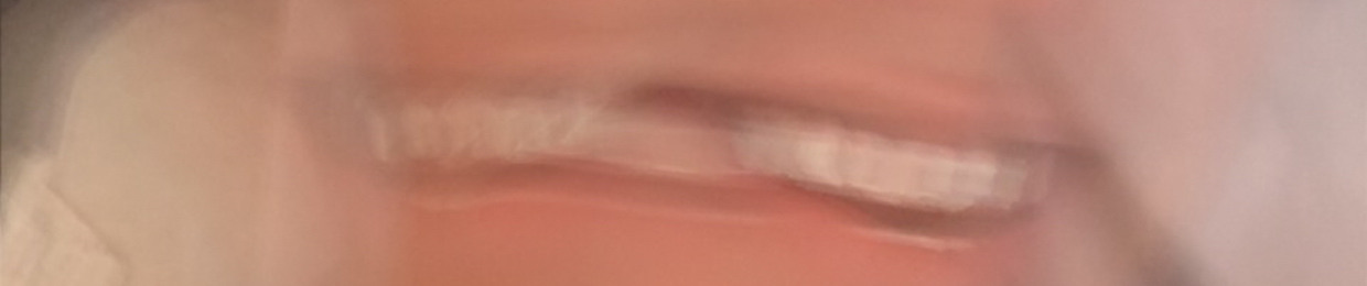 rzn