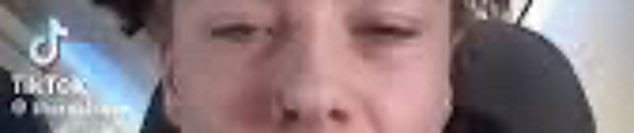 skux1
