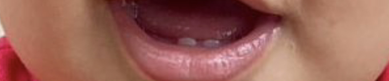 a_enyarrol