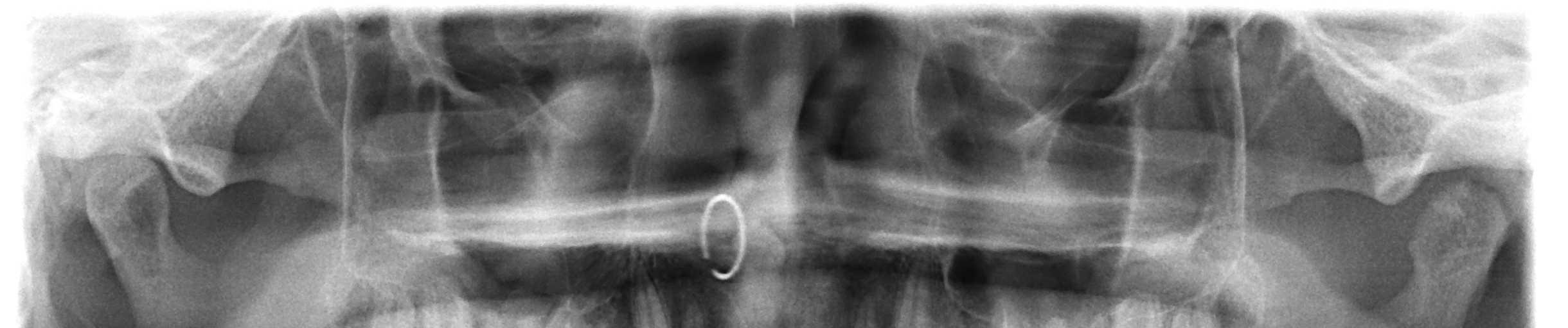 Stream MUGSHOT by Sasha Molnin | Listen online for free on SoundCloud