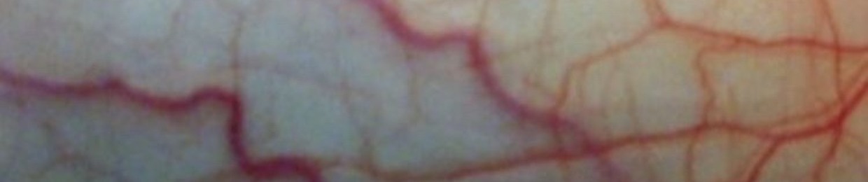 infinitt*