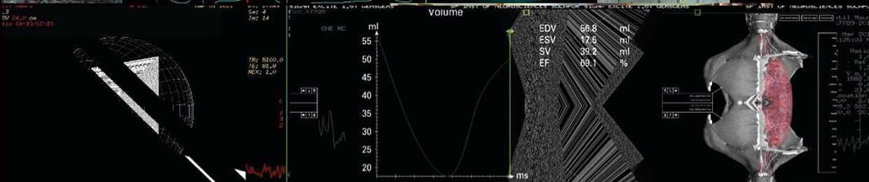 AVTV  Audio Video Techno Visual