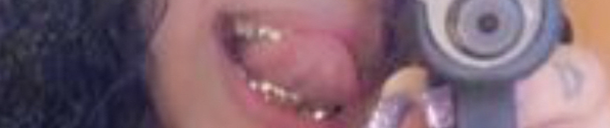 7em