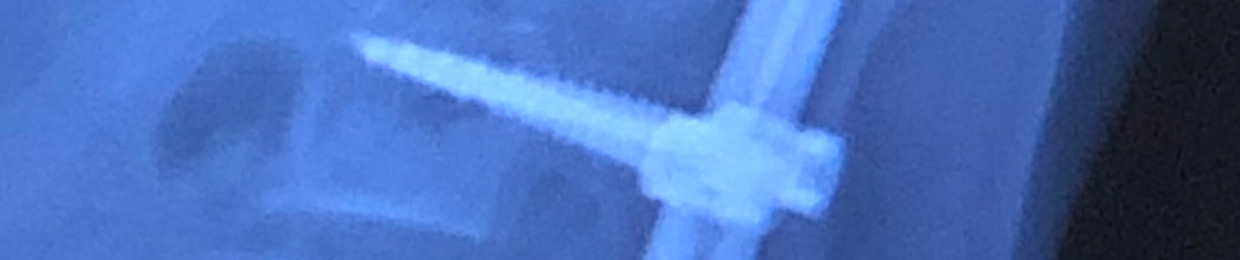 nxll.exe