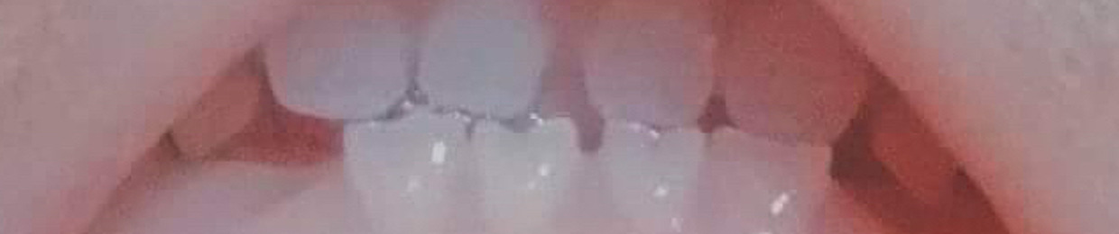 pastelnoize