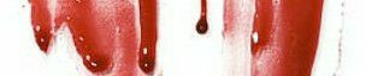 Perfect Impurity