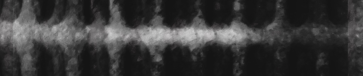 Azimuth