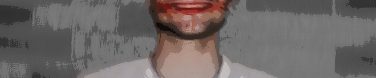 VIZION