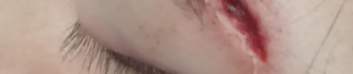 Sockeye